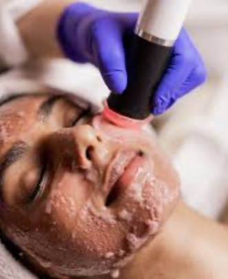 Glo2 Facial With Dermaplaning