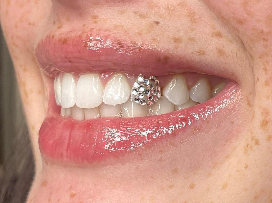 Disco Ball Tooth