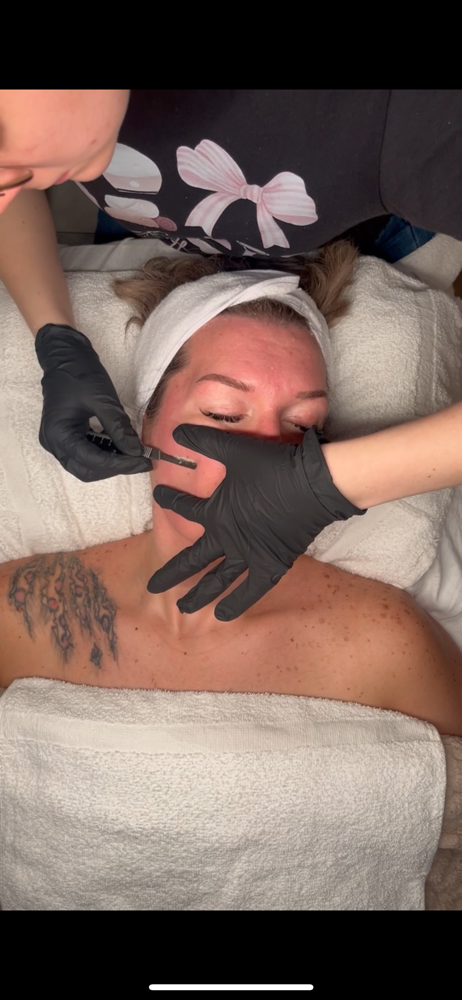 Dermaplane Facial