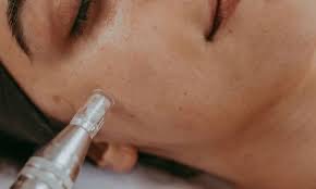 Nano Infusion -Add On