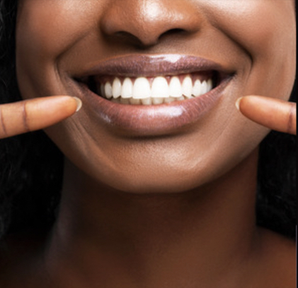 Platinum Smile Treatment