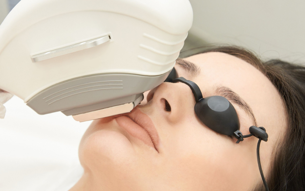 Laser Skin Resurfacing