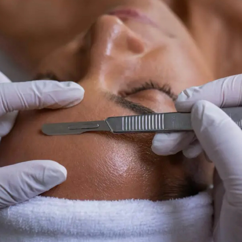 Dermaplane ADD ON at SweetLea Massage and Aesthetics in Plymouth, WI