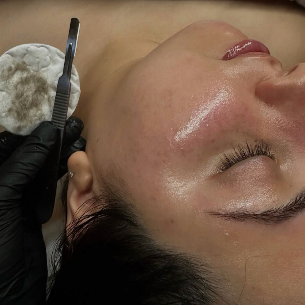 Summer Skin Special at Glo by Vero in Pacific, MO