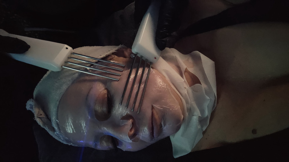 Non Surgical FaceLift at Current Beauty in Chandler, AZ