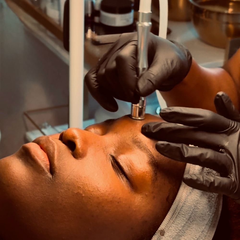 Microdermabrasion at Skin by Amile in Oxon Hill, MD