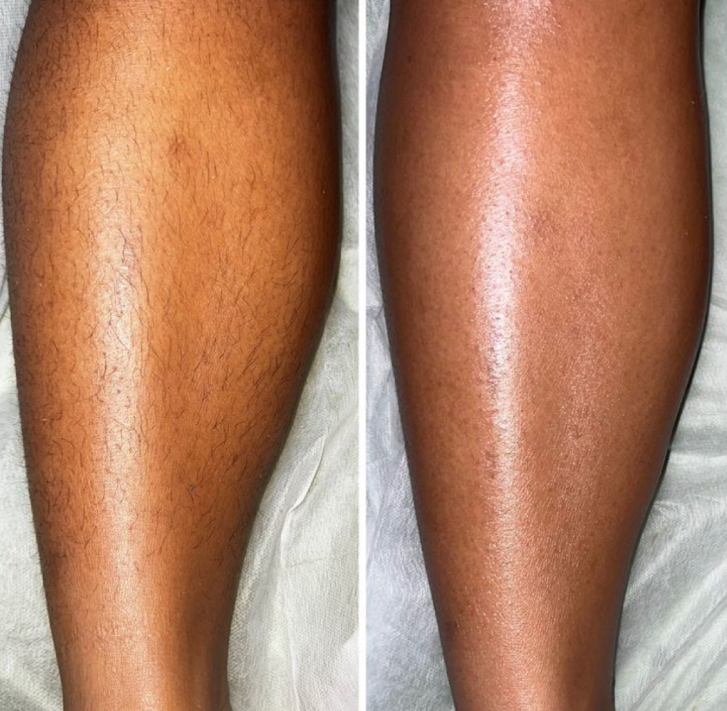 Half Leg Wax at Jontahontas’ Collection LLC. in Greenville, SC
