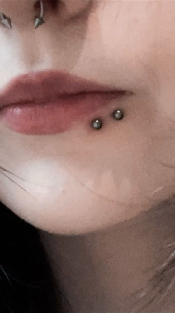 Spiderbites