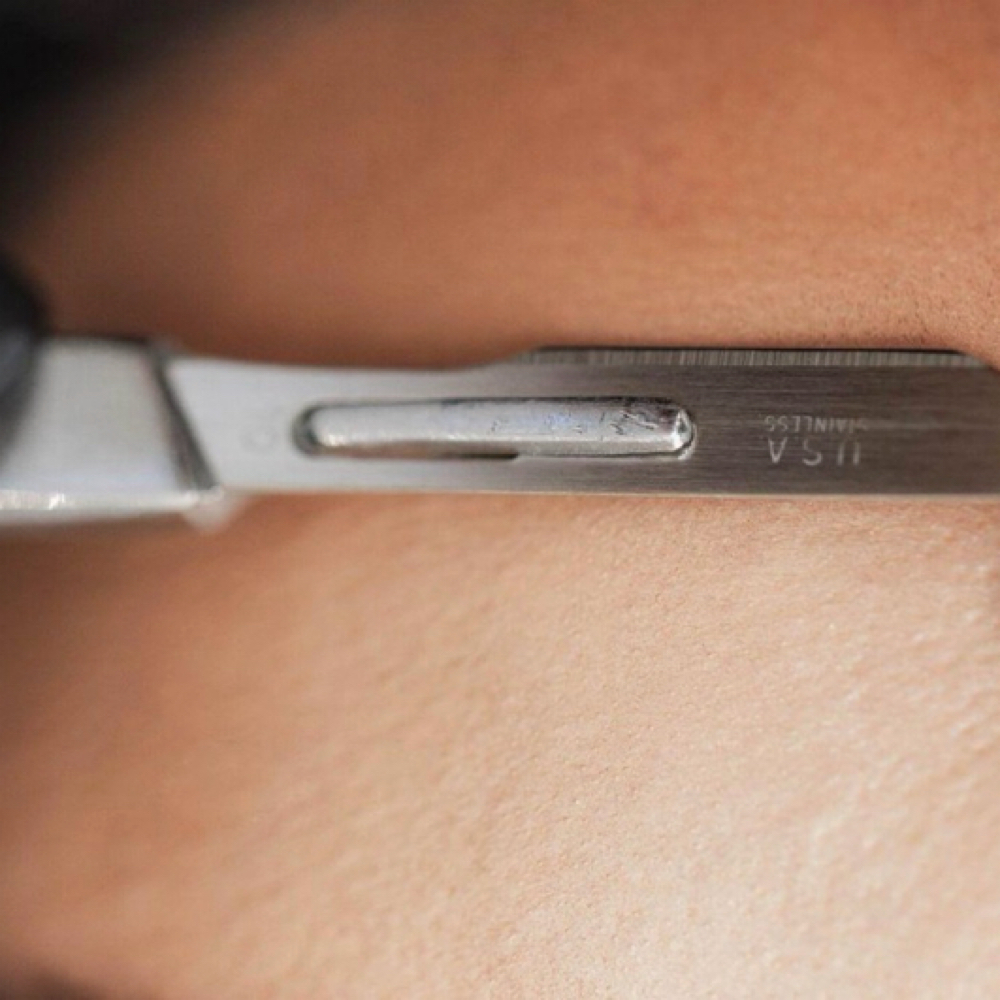 Dermaplaning Refinement at Redeemed Radiance Aesthetics & Cosmetic Injections in San Antonio, TX