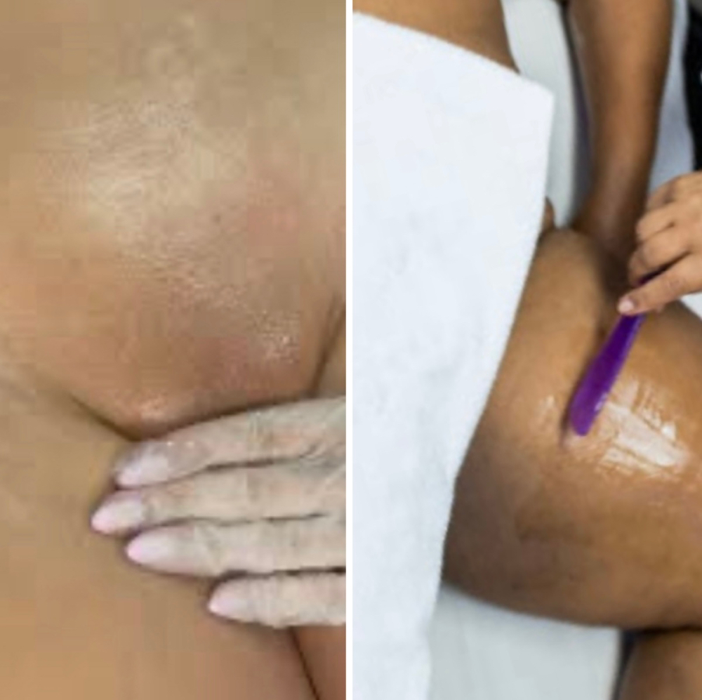 COMBO 3 (Brazilian & Inner Thigh)