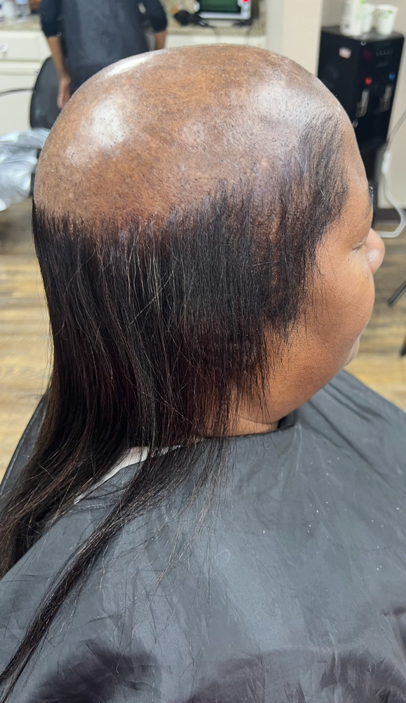 Non Surgical Hair Replacment
