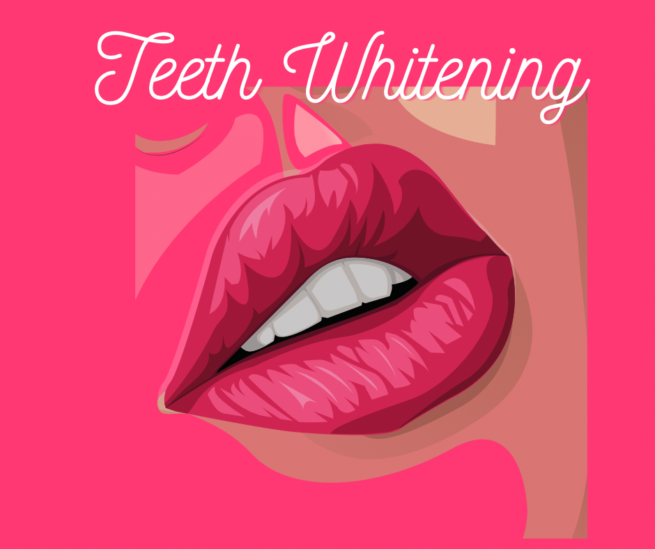 Teeth whitening