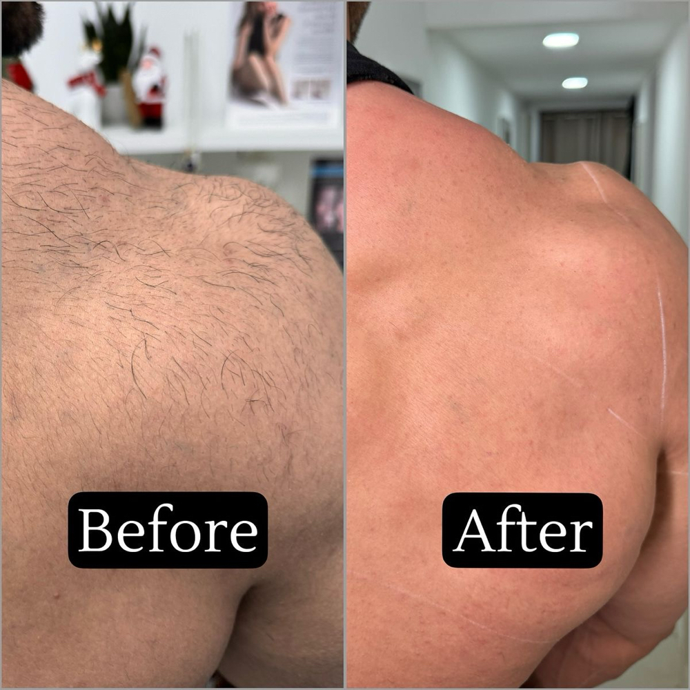 Upper Back at Charismatic Beauty in Apple Valley, CA