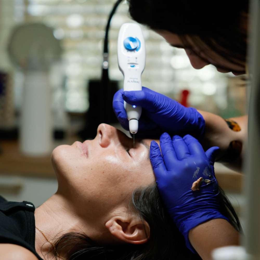 Plasma Lift Forehead Tightening at Makeup N Giggles in Key West, FL