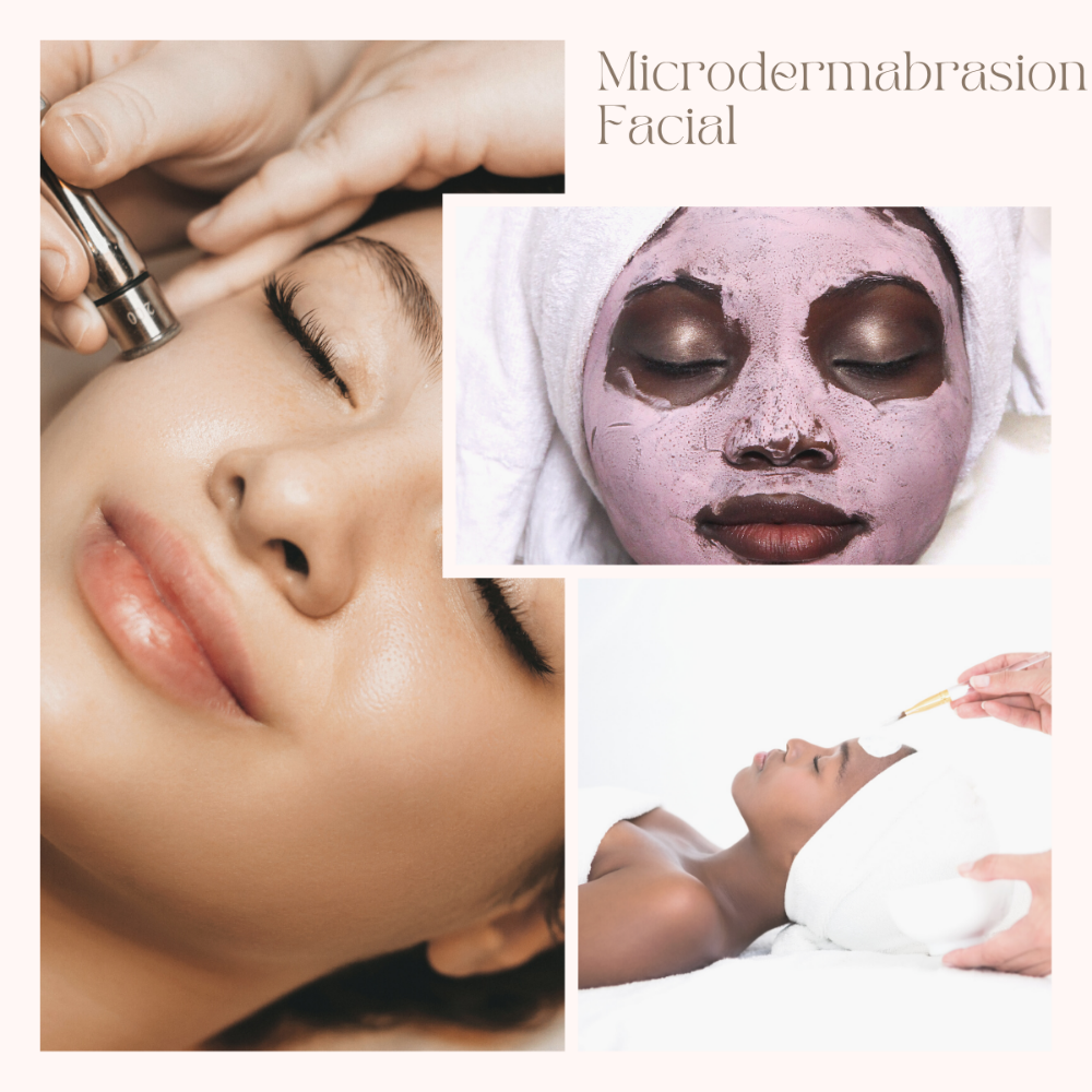Microdermabrasion facial