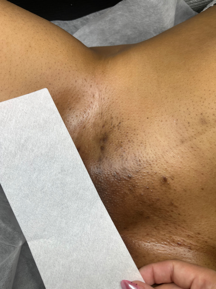 Brazilian Wax