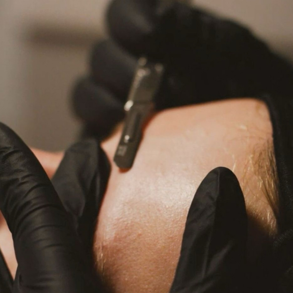 Dermaplane Facial at Liberty Health and Beauty in Waterville, ME