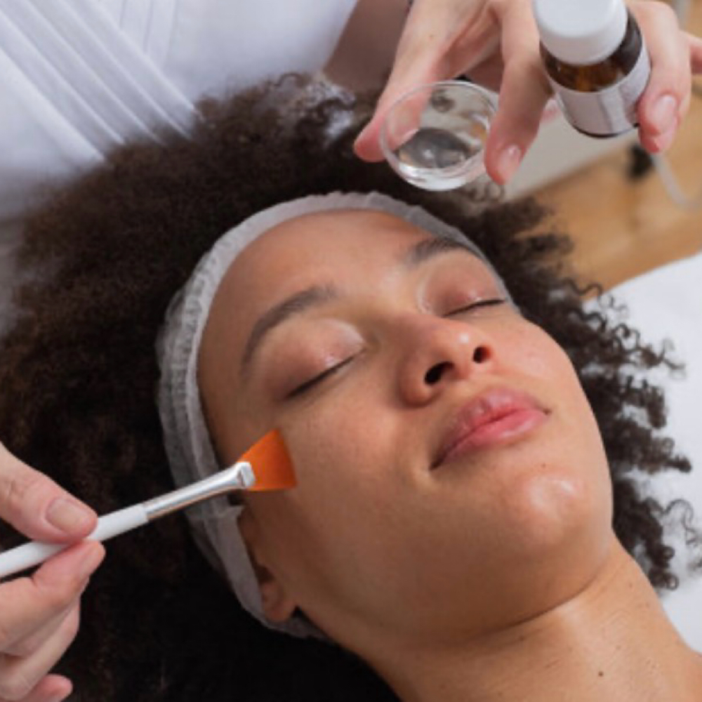 Chemical Peel at Skin by Nanouka in Catonsville, MD