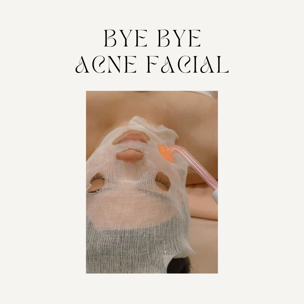 bye bye acne facial