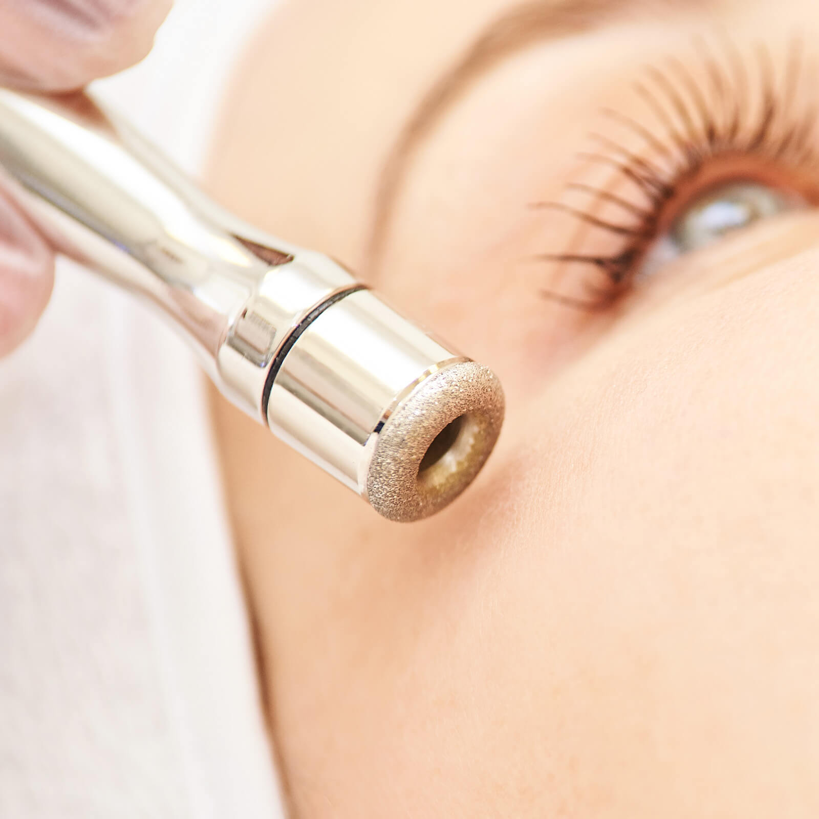 Microdermabrasion