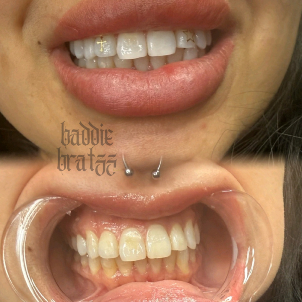 90 Minute Teeth Whitening at Baddie Bratzz LLC in Phoenix, AZ
