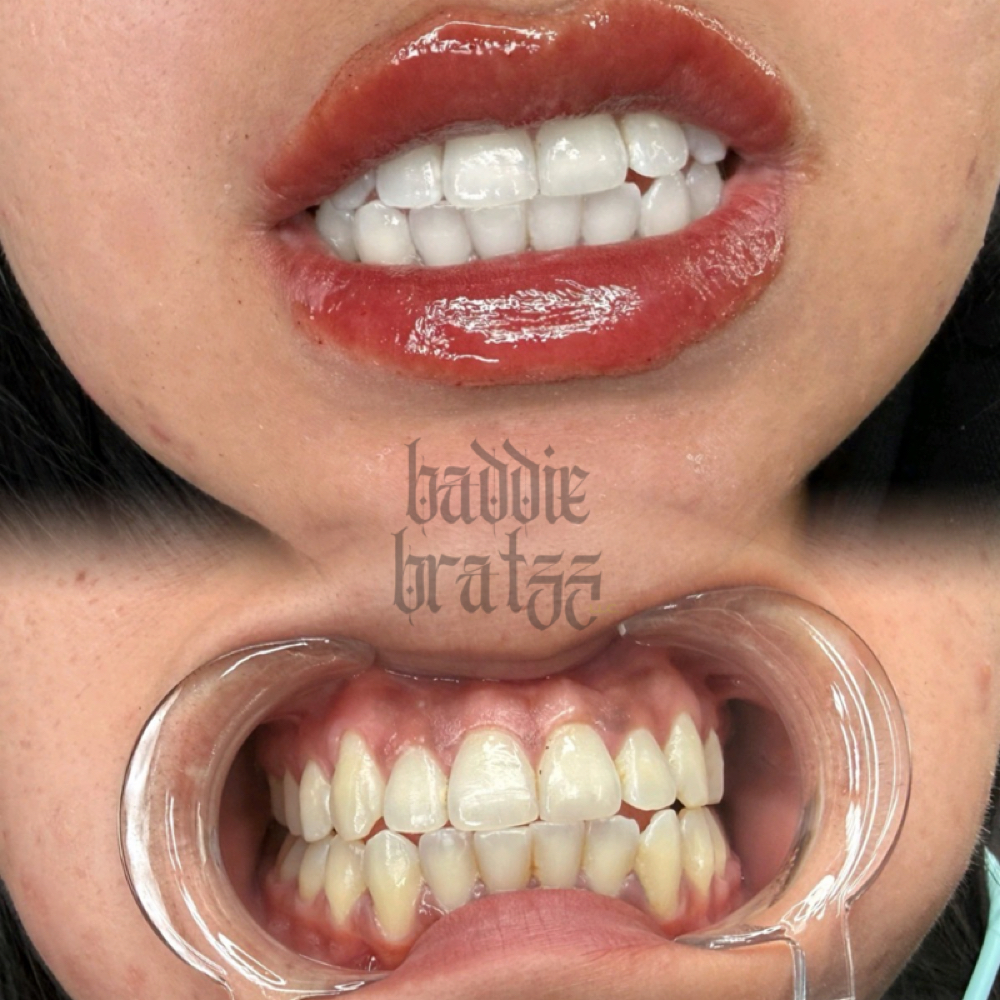 90 Minute Teeth Whitening at Baddie Bratzz LLC in Phoenix, AZ