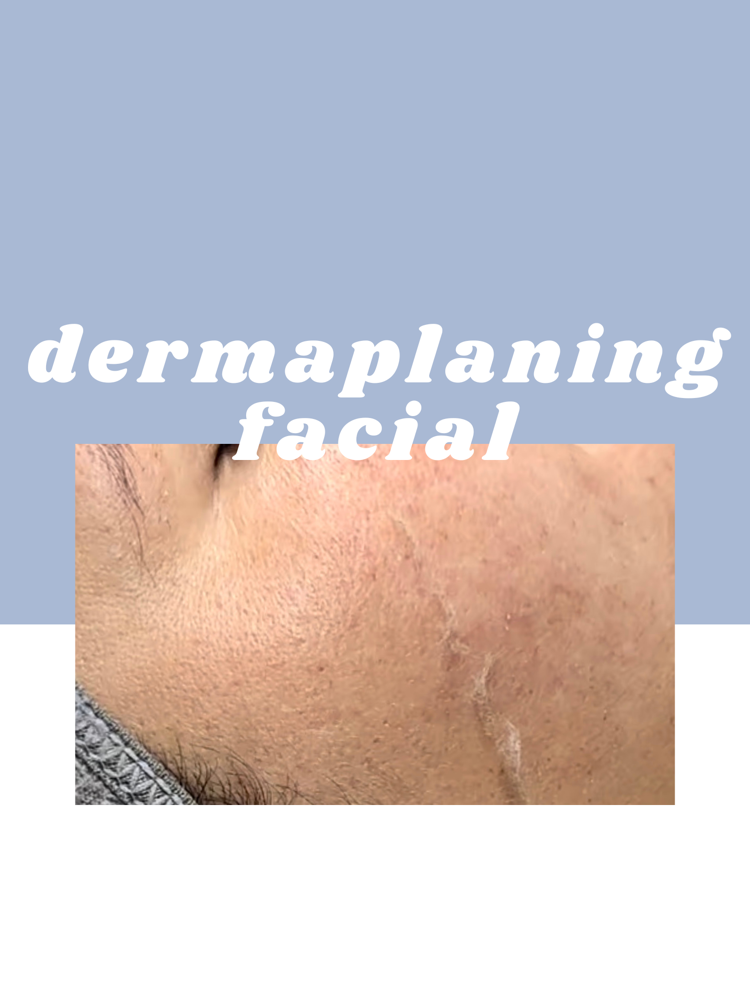 Dermaplaning Facial