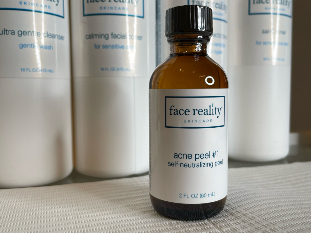 Acne Bootcamp Treatment (Face)