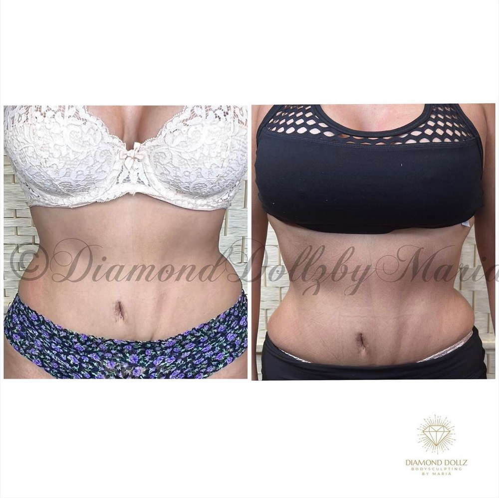 Promo (5 Session) 1 Free