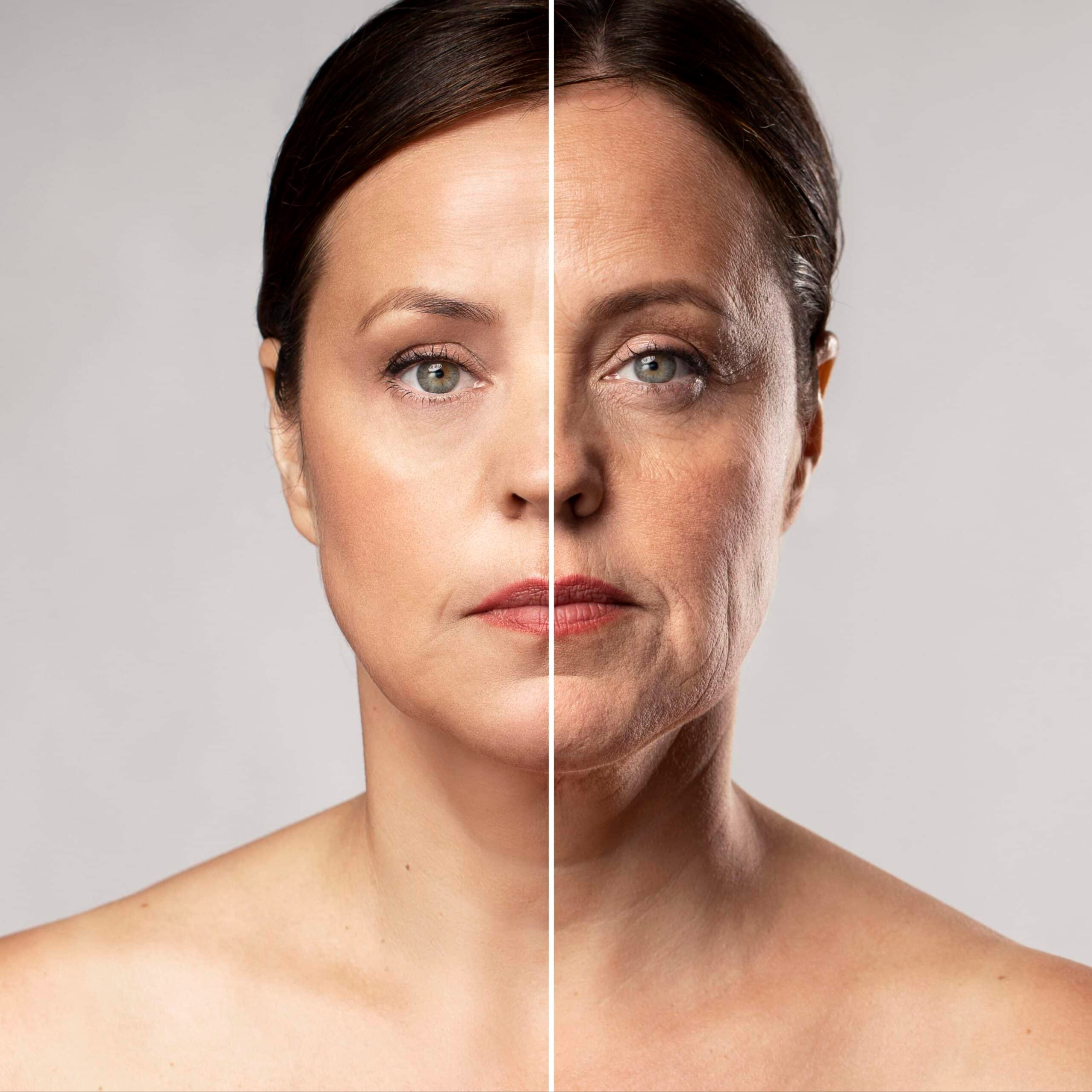 Microneedling at perrenia wellness in Shallotte, NC