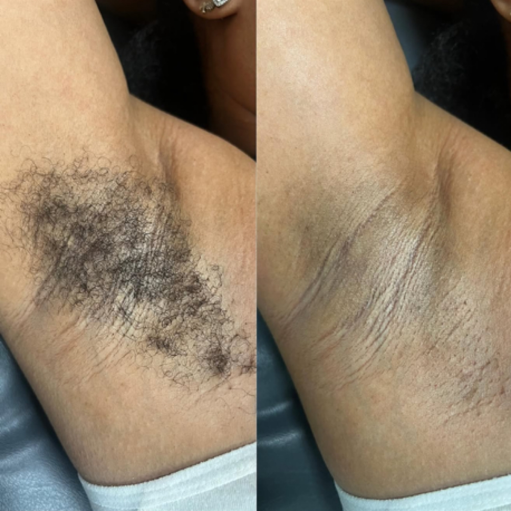 Underarm at BrittGotWaxx in Beavercreek, OH