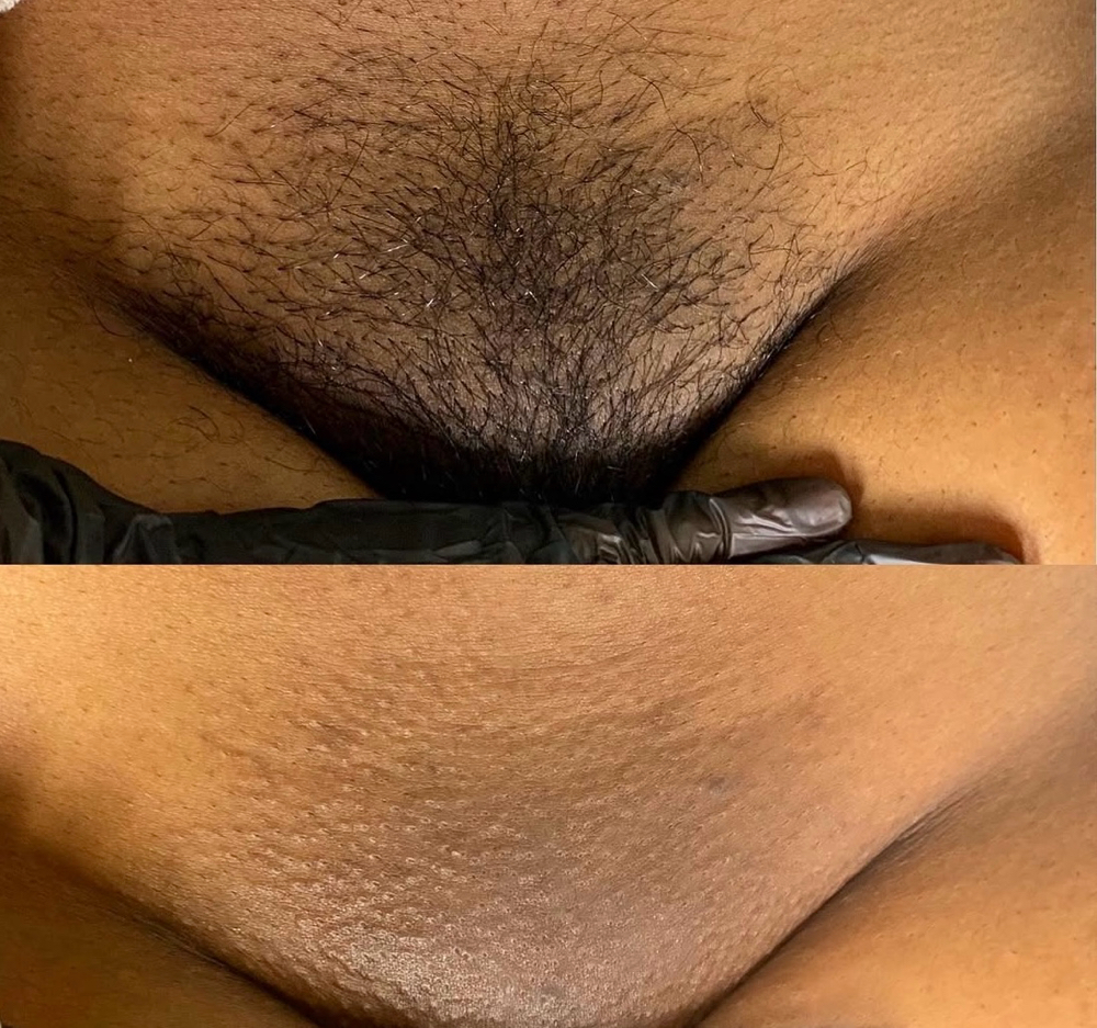 Extended Brazilian Plus