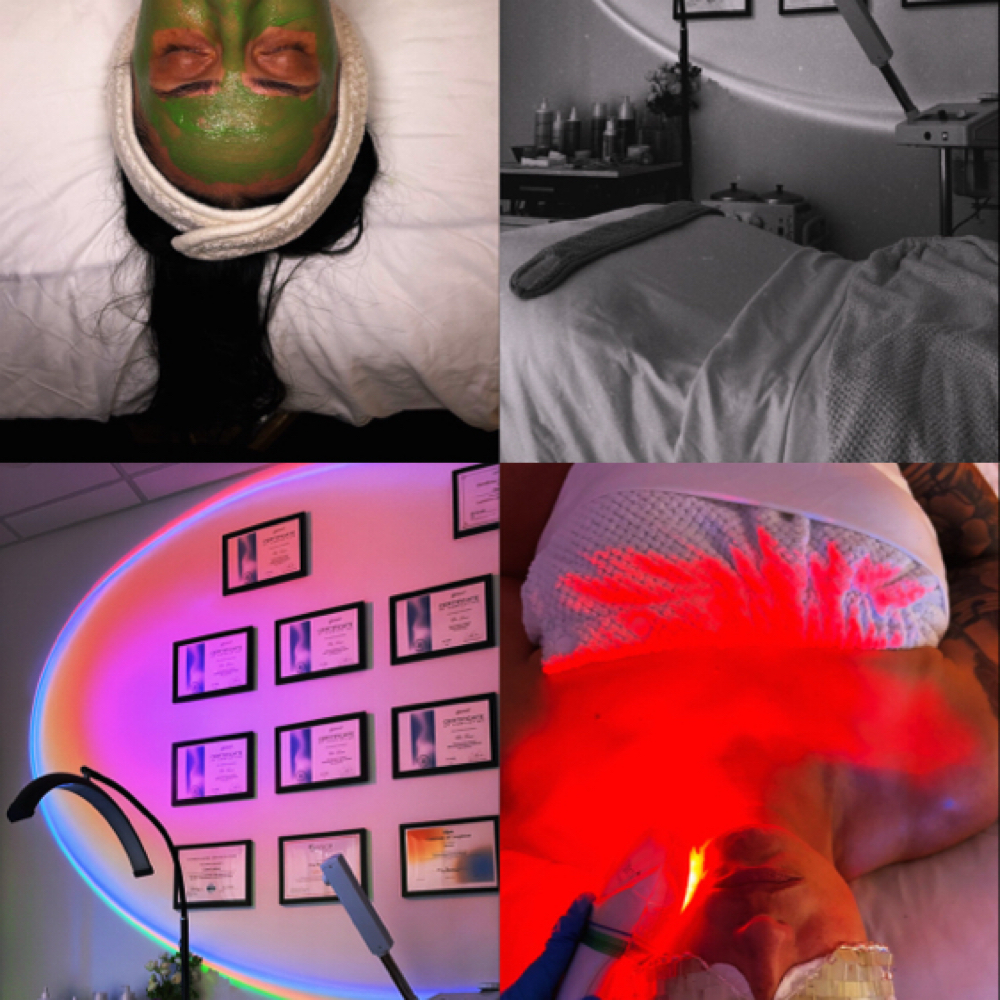 Facials, Chemical Peels, And More! at Glo by Clo Esthetics in Petaluma, CA