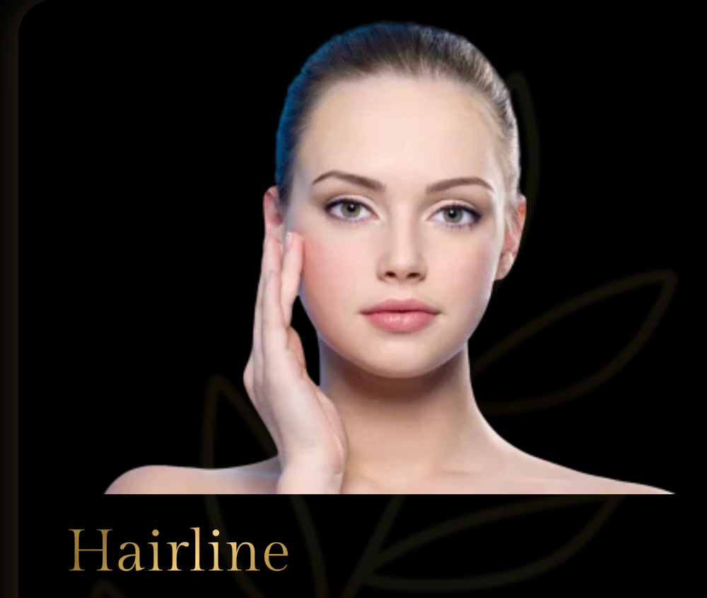 Hairline