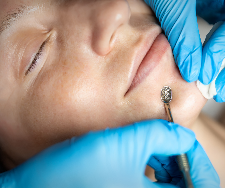 Extractions (Add-On)