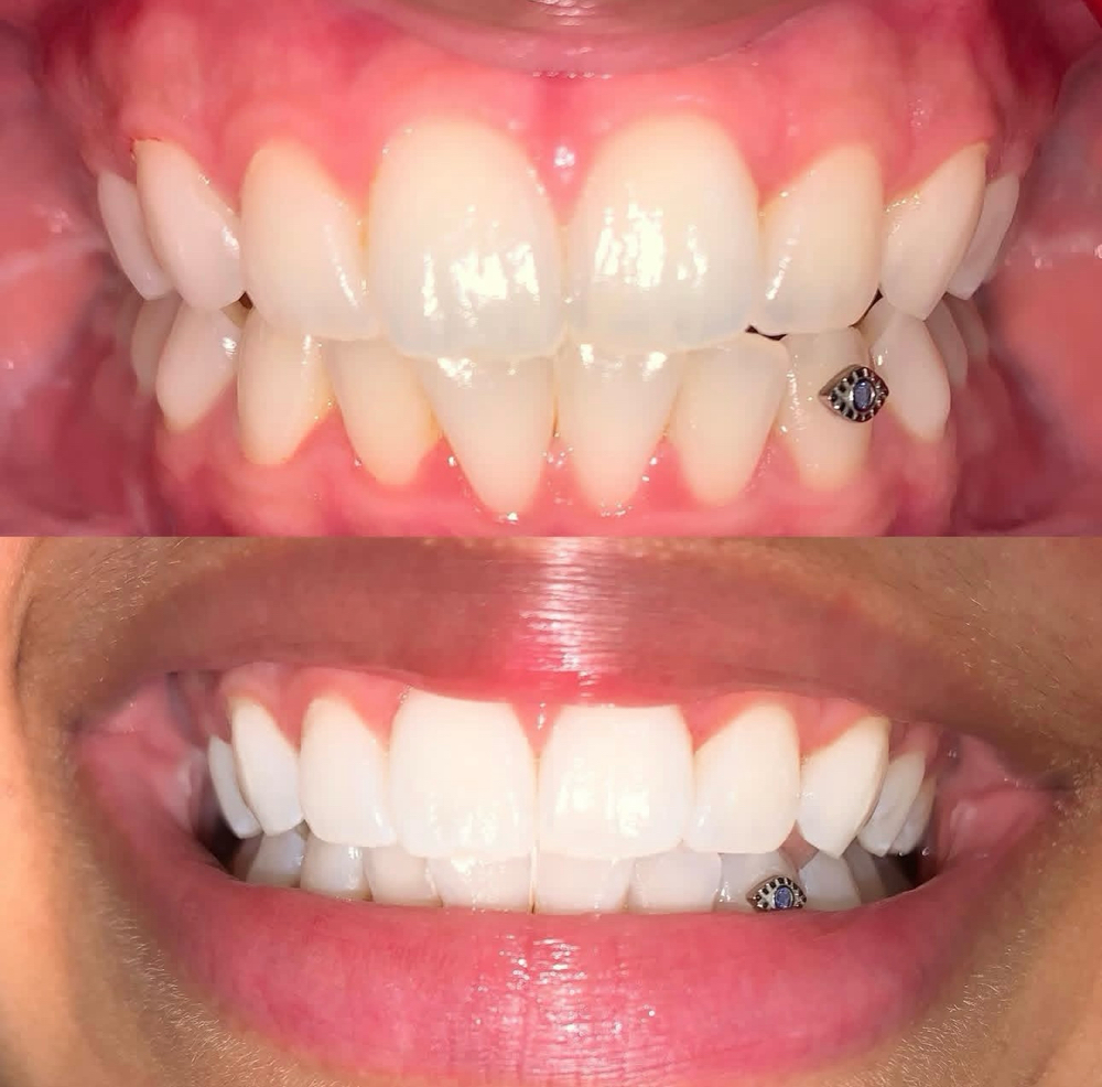 MAL DE OJO🧿 [SAPPHIRE X GOLD]™