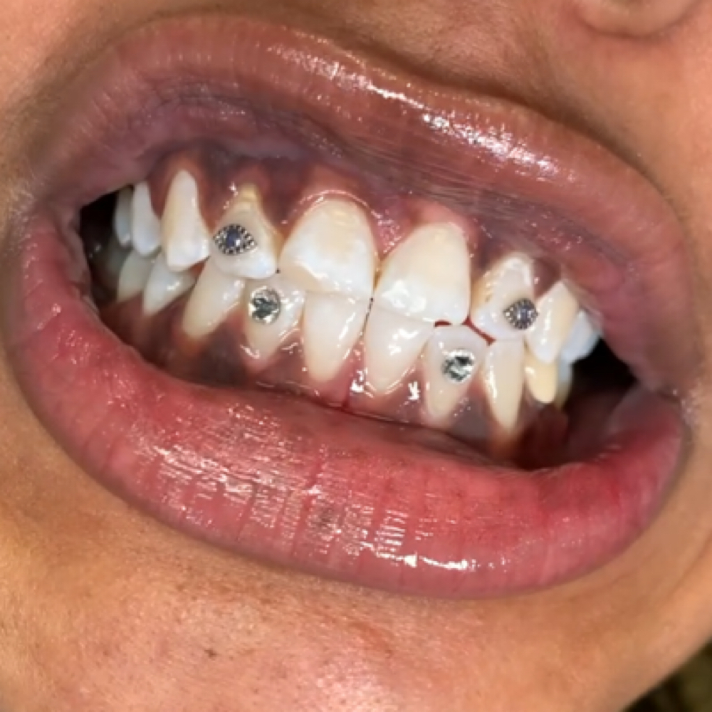 MAL DE ORO 🧿 EVIL EYEᴺᴶ at MONMOUTH COUNTYᴺᴶ ✧ 1ST TOOTH JEWELER ↯ #POPURWAXINCHERRY in Hazlet, NJ