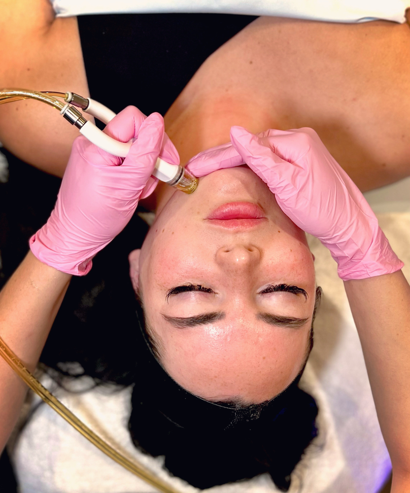 DiamondGlow at Purely Aesthetic in Phoenix, AZ