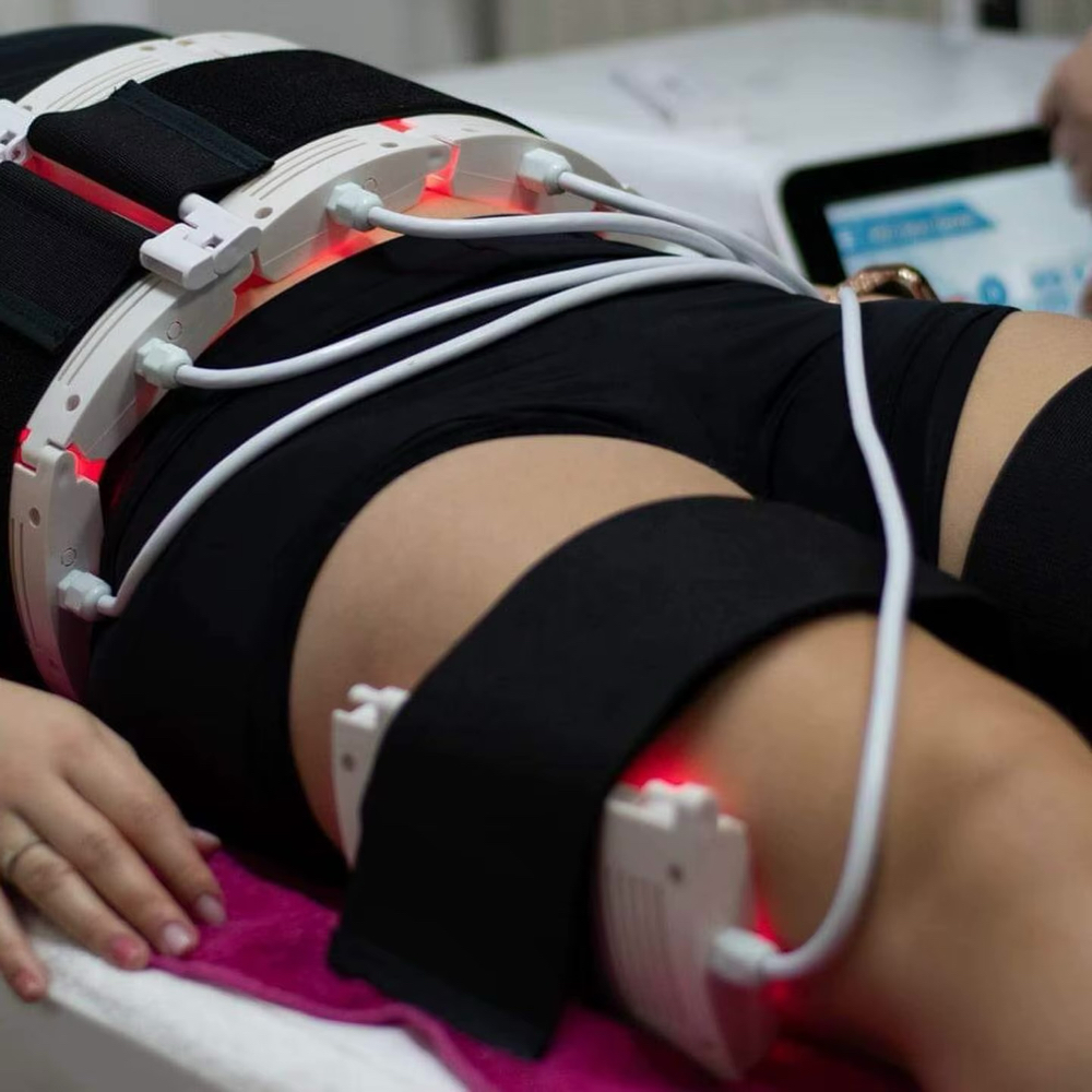 Lipo Lasers at Glam Lab in Rancho Cucamonga, CA