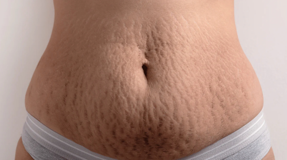 6-Session Treatment Package