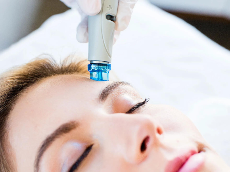 hydradermabrasion
