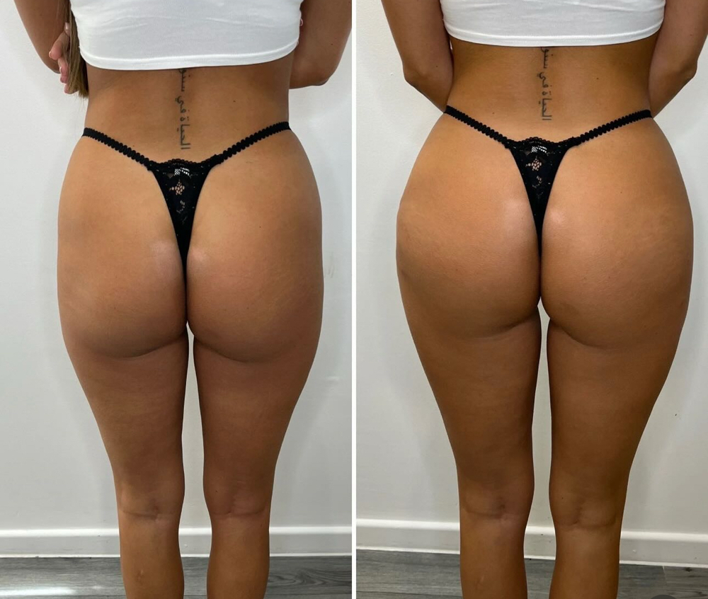 Mood B00ty Luxe ✨600ml