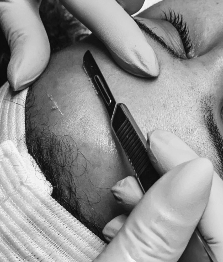 Express Dermaplane