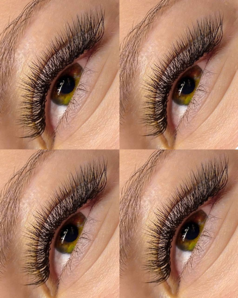 Volume Refill (4 weeks)