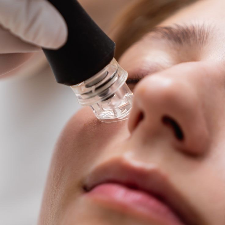 HYDRAFACIAL at Remake Beauty Studio San Juan in San Juan, TX