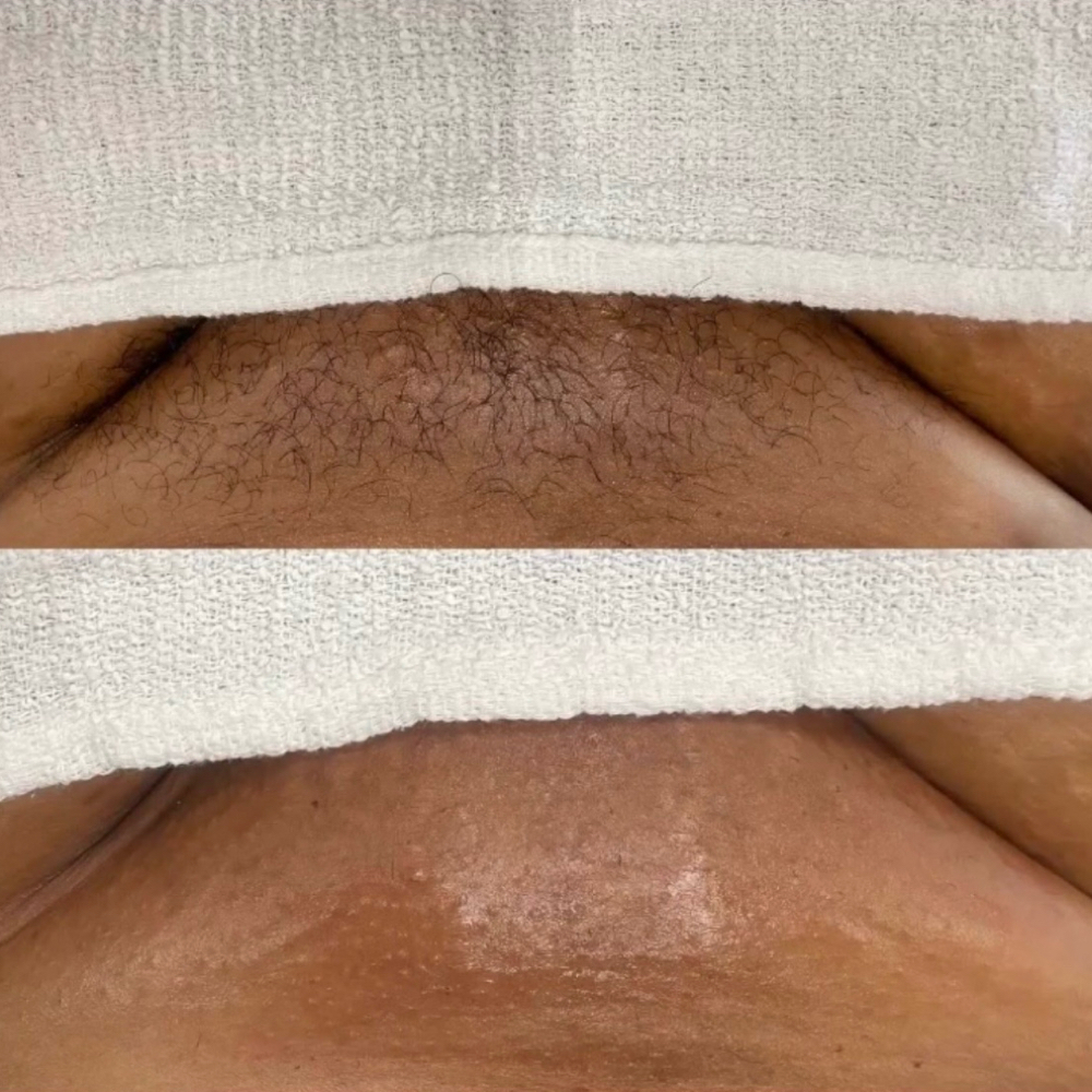 Brazilian(Females Only) at Reflections Within Spa in Sharpsburg, GA