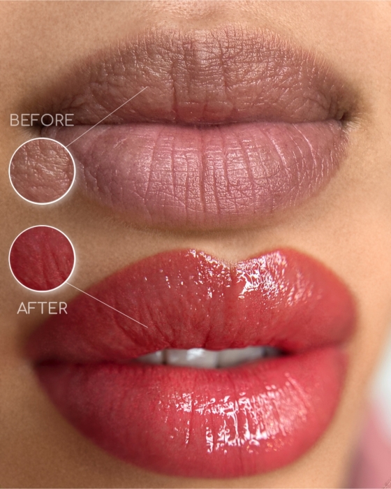 Dark Lips Neutralization