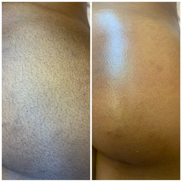 Full Butt at Belladz Wax Studio in Beltsville, MD