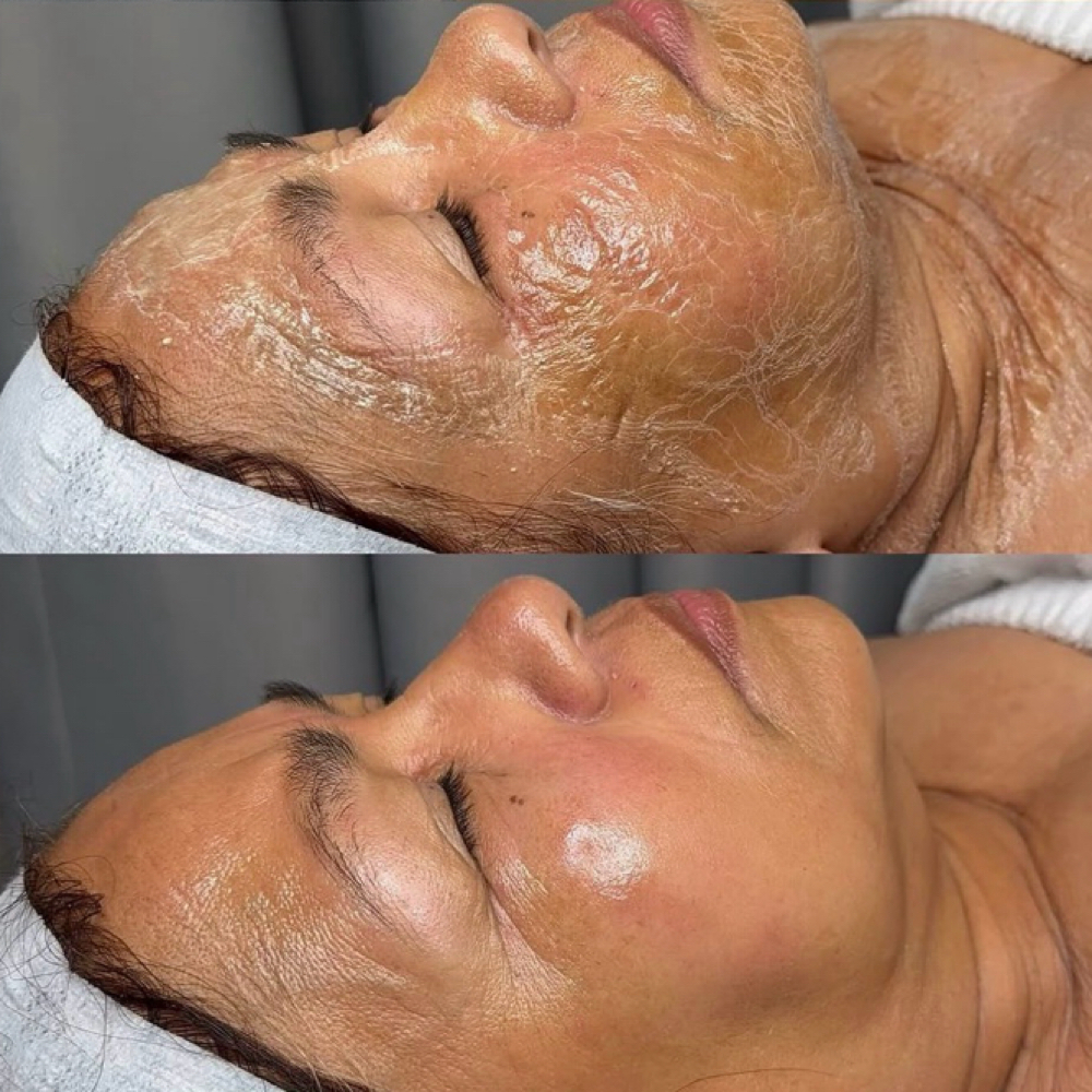 ✨CIRCADIA Firming Peptide Facial✨ at Everé Head Spa in Duncanville, TX