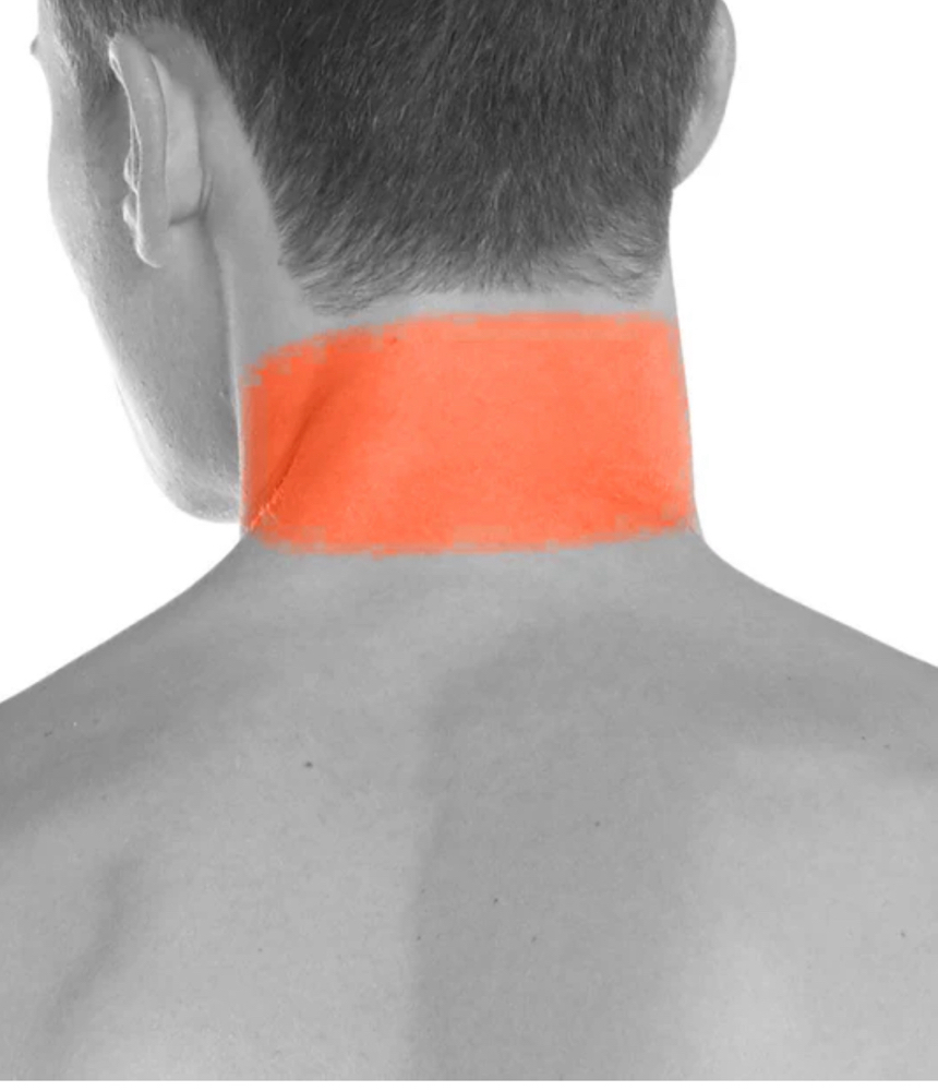 Neckline (Front Or Back) Laser Hair